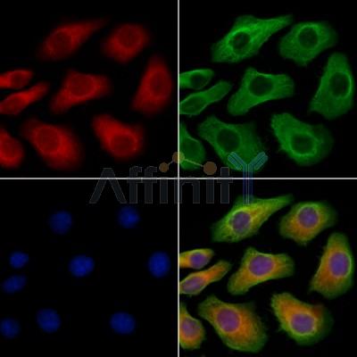 TBC1D2 Antibody - DF9957 staining Hela cells by IF/ICC.