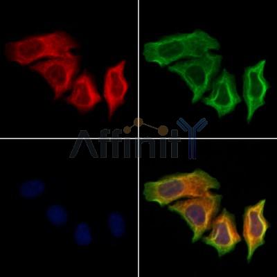 TNNT1 Antibody - DF9976 staining Hela cells by IF/ICC.