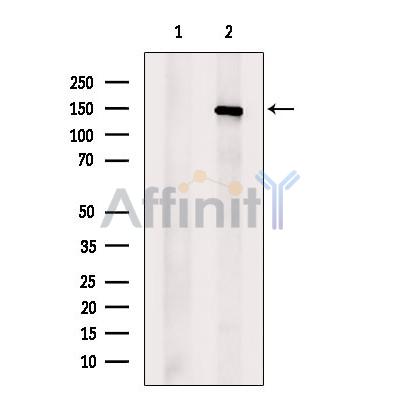 UBE4B Antibody - Western blot analysis of extracts from EC304 cells, using UBE4B Antibody.
