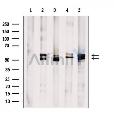 pan-AKT1/2/3 Antibody - Western blot analysis of extracts from various samples, using AKT1/2/3 Antibody.