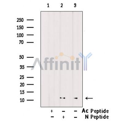 Acetyl-Histone H4 (Lys91) Antibody - Western blot analysis of extracts from HeLa cells(TSA 1M, 18 hr), using Acetyl-Histone H4 (Lys91) Antibody.