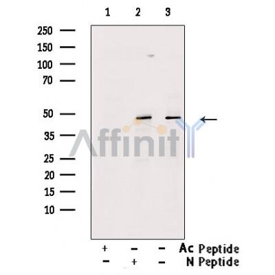 Acetyl-p53 (Lys373) Antibody - Western blot analysis of extracts from MDA-MB-435  cells(TSA 1M, 18 hr), using Acetyl-p53 (Lys373) Antibody.