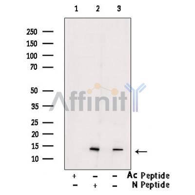 Acetyl-H2A.Z (Lys4/7/11/13) Antibody - Western blot analysis of extracts from HeLa  cells(TSA 1M, 18 hr), using Acetyl-H2A.