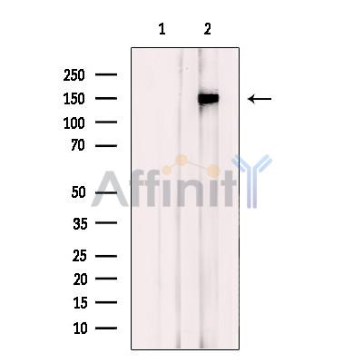 GKAP Antibody - Western blot analysis of extracts from Jurkat , using GKAP Antibody.