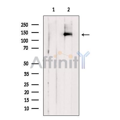 BACH1/BRIP1 Antibody - Western blot analysis of extracts from MCF7, using BACH1/BRIP1 Antibody.