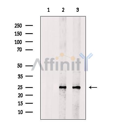 VEGFA Antibody - Western blot analysis of extracts from various samples, using VEGF Antibody.