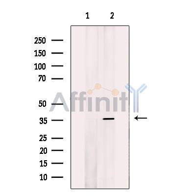 AQP0 Antibody - Western blot analysis of extracts from mouse eye tissue, using AQP0 Antibody.
