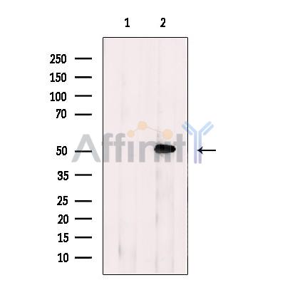AP2 alpha Antibody - Western blot analysis of extracts from COLO205, using AP 2 Antibody.