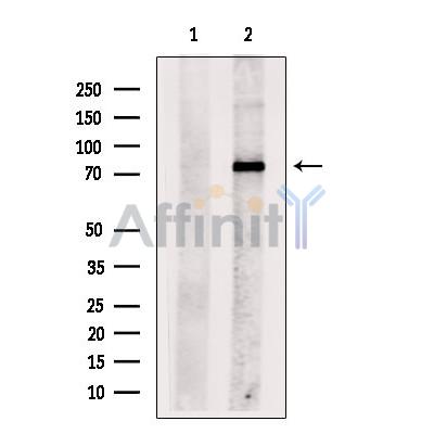 Catenin gamma Antibody - Western blot analysis of extracts from Rat  brain, using Catenin gamma Antibody.