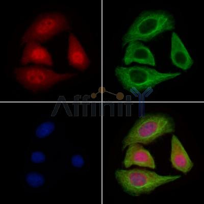IKK alpha/ beta Antibody - AF6014 staining Hela cells by IF/ICC.