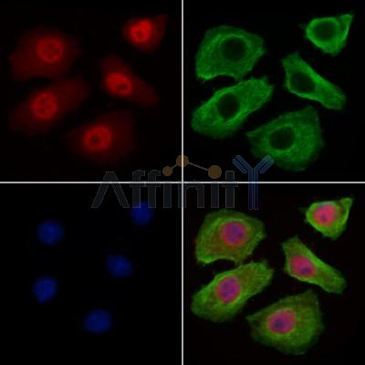 Bcl-2 Antibody - AF6139 staining Hela cells by IF/ICC.