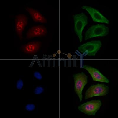 STAT3 Antibody - AF6294 staining Hela cells by IF/ICC.