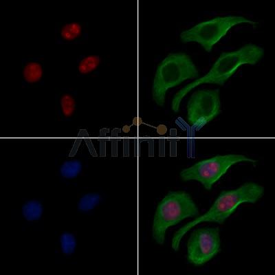STAT3 Antibody - AF6295 staining Hela cells by IF/ICC.