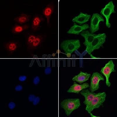 Caspase 9 Antibody - AF6348 staining Hela cells by IF/ICC.