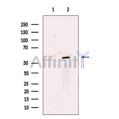 N-WASP Antibody - Western blot analysis of extracts from A431 , using N-WASP Antibody.