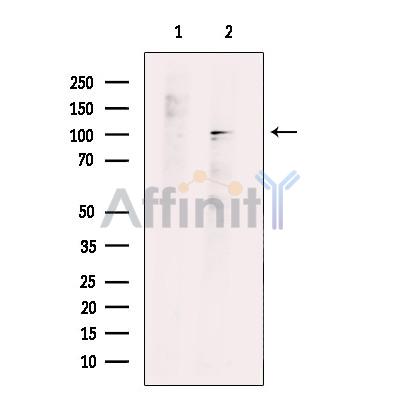 BACH1 Antibody - Western blot analysis of extracts from HeLa, using BACH1 Antibody.