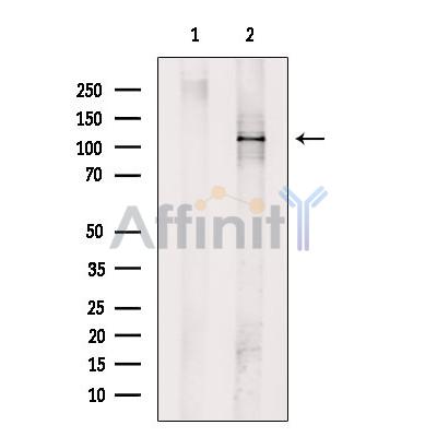 ULK1 Antibody - Western blot analysis of extracts from 293t, using ULK1 Antibody.