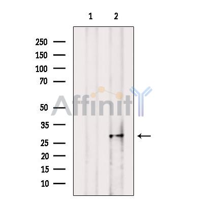 PZR Antibody - Western blot analysis of extracts from Mouse  kidney, using PZR Antibody.