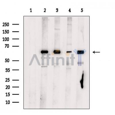PKM2 Antibody - Western blot analysis of extracts from various samples, using PKM2 Antibody.