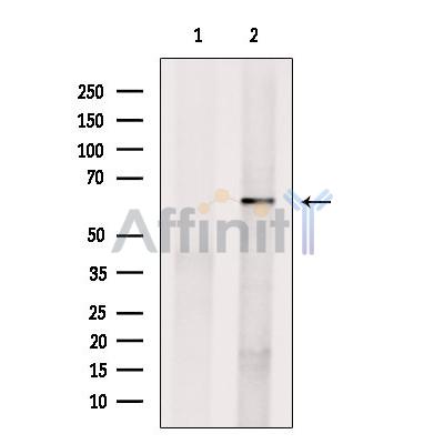 MyoD1 Antibody - Western blot analysis of extracts from B16F10 cells, using MYOD Antibody.