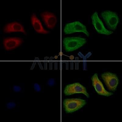 JAK1 Antibody - AF7765 staining Hela cells by IF/ICC.