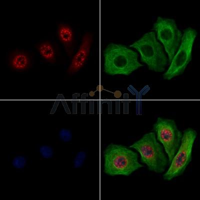 MAPKAPK2 Antibody - AF7808 staining Hela cells by IF/ICC.