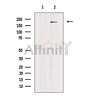 Afadin Antibody - Western blot analysis of extracts from Mouse hippocampal tissue, using Afadin Antibody .
