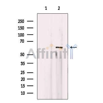 ERK8 Antibody - Western blot analysis of extracts from Jurkat, using ERK8 Antibody.