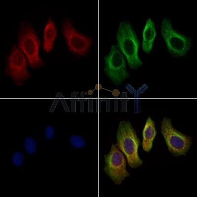 Rabr Antibody - AF9177 staining Hela cells by IF/ICC.