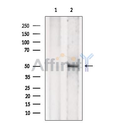 TBL2 Antibody - Western blot analysis of extracts from Hela cells, using TBL2 Antibody.