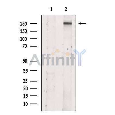 ZNF462 Antibody - Western blot analysis of extracts from MDA-MB231, using ZNF462 Antibody.