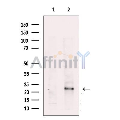 R-Ras Antibody - Western blot analysis of extracts from Mouse spleen tissue, using R-Ras Antibody.