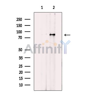 IFT81 Antibody - Western blot analysis of extracts from HEK-293 cells, using IFT81 Antibody.