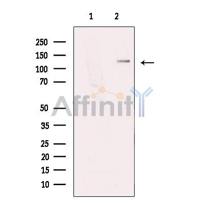 NBR1 Antibody - Western blot analysis of extracts from HeLa cells, using NBR1 Antibody.