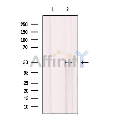 CRBN Antibody - Western blot analysis of extracts from mouse heart tissue, using CRBN Antibody.