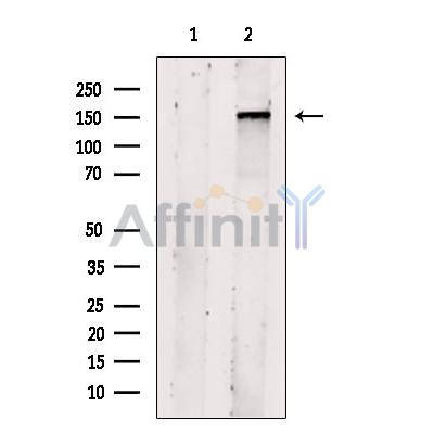 KIAA1199 Antibody - Western blot analysis of extracts from B16F10 cells, using KIAA1199 Antibody.