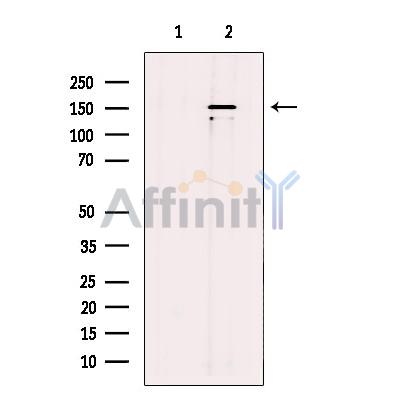 KIAA1199 Antibody - Western blot analysis of extracts from COLO 320 cells, using KIAA1199 Antibody.