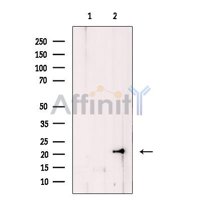 COMMD1 Antibody - Western blot analysis of extracts from human liver tissue, using COMMD1 Antibody.