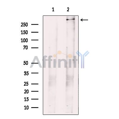 Piezo1 Antibody - Western blot analysis of extracts from rat brain, using Piezo1 Antibody.