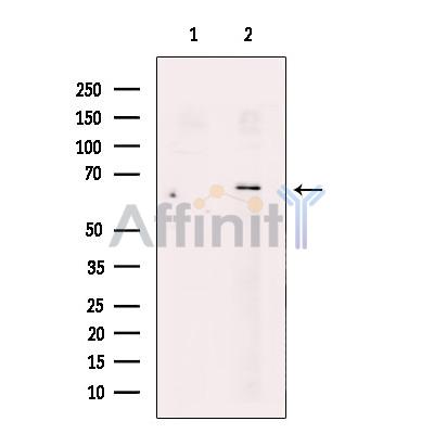 ZnT7 Antibody - Western blot analysis of extracts from A549 cells, using ZnT7 Antibody.