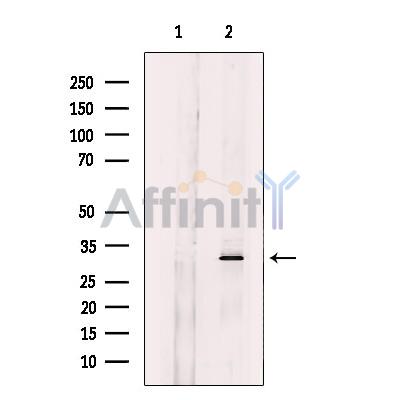 CHMP2A Antibody - Western blot analysis of extracts from HeLa cells, using CHMP2A Antibody.