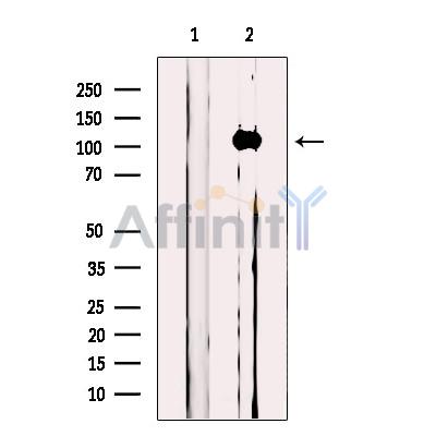 MICAL1 Antibody - Western blot analysis of extracts from Jurkat cells, using MICAL1 Antibody.