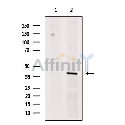 TIA1 Antibody - Western blot analysis of extracts from B16F10 cells, using TIA1 Antibody.