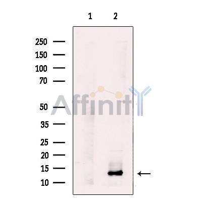 UQCRB Antibody - Western blot analysis of extracts from HeLa cells, using UQCRB Antibody.