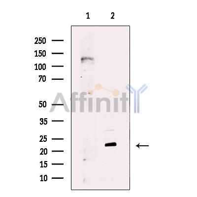 PPPDE1/PNAS4 Antibody - Western blot analysis of extracts from A549 cells, using PPPDE1/PNAS4 Antibody.