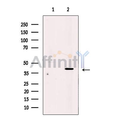 PRPH2 Antibody - Western blot analysis of extracts from mouse eye tissue, using PRPH2 Antibody.