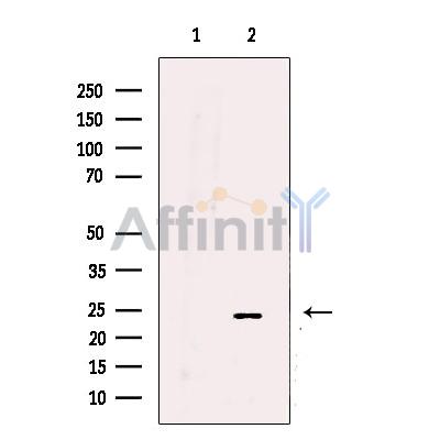 UQCRFS1 Antibody - Western blot analysis of extracts from MCF-7 cells, using UQCRFS1 Antibody.