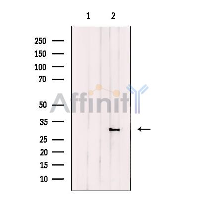 CPSF4 Antibody - Western blot analysis of extracts from HeLa cells, using CPSF4 Antibody.