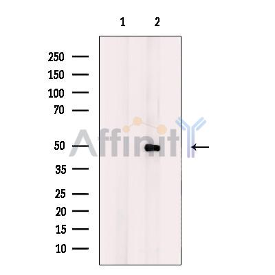 DYX1C1 Antibody - Western blot analysis of extracts from rat testis tissue, using DYX1C1 Antibody.