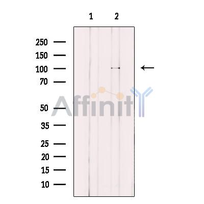 KIF18A Antibody - Western blot analysis of extracts from HeLa cells, using KIF18A Antibody.